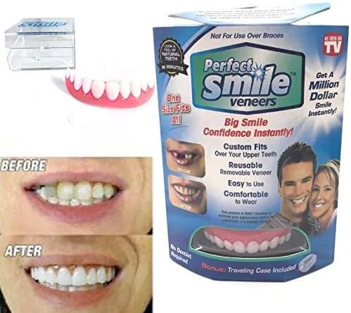 Perfect Smile Veneers