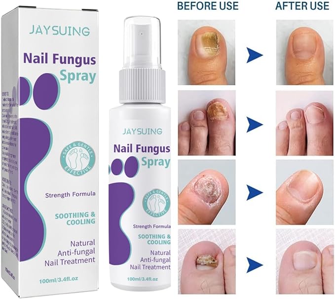 Cooling Nail Care Spray