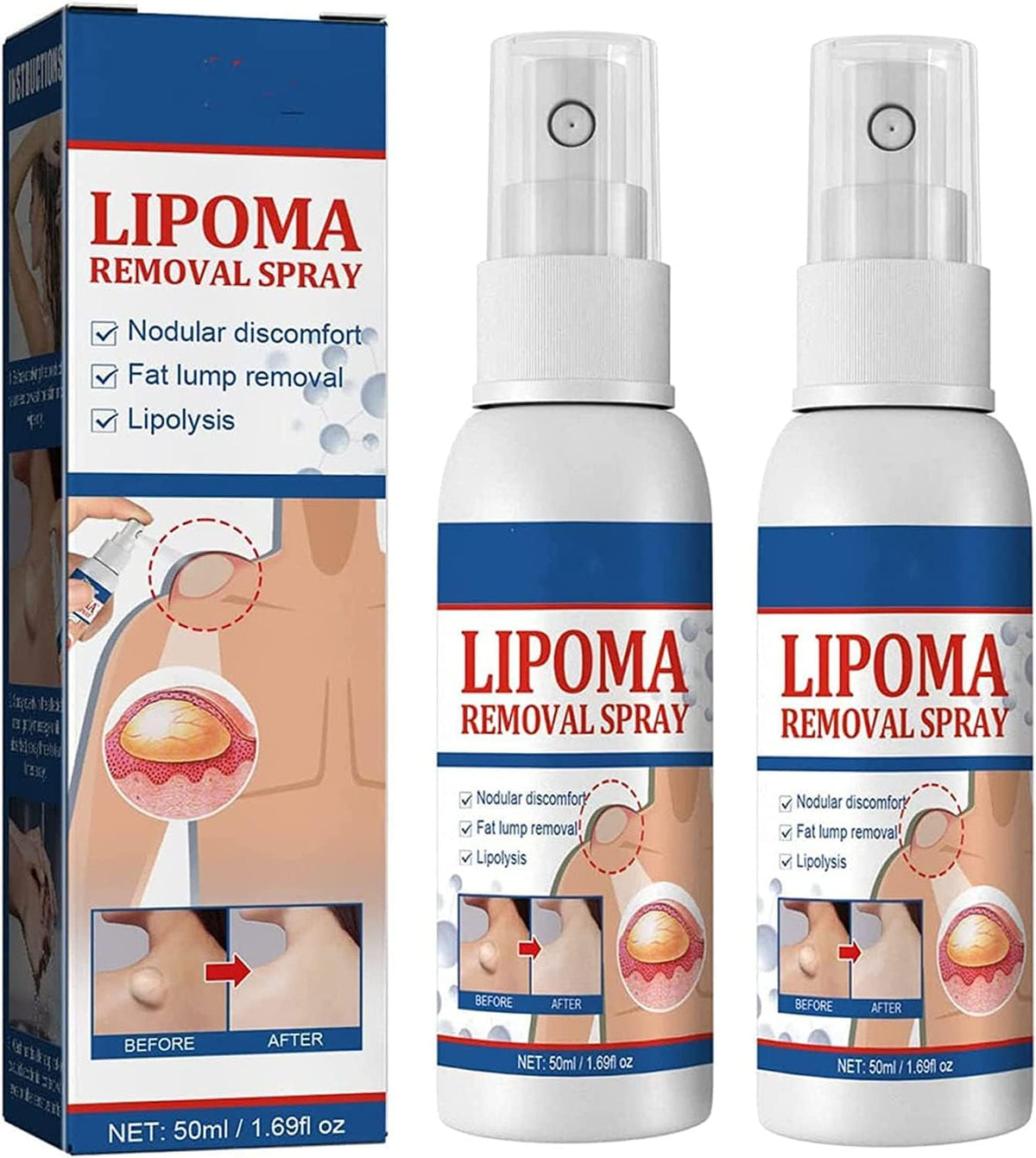 Topical Spray, 50ml